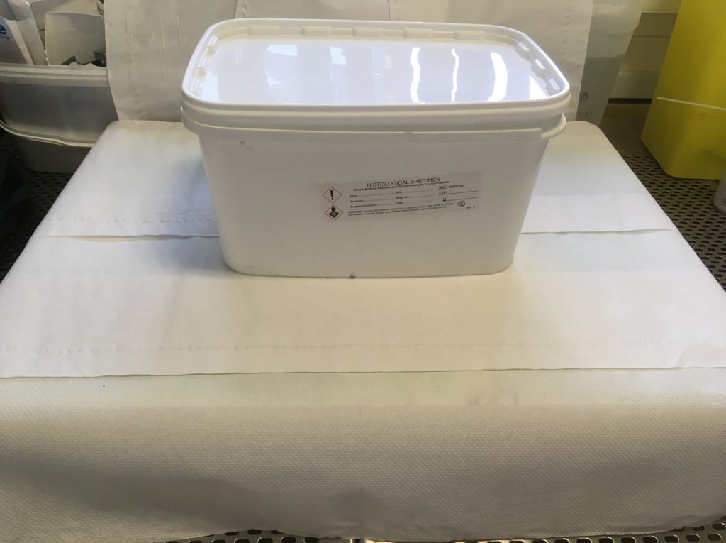 Formalin filled specimen containers / Cellular Pathology / Exeter ...