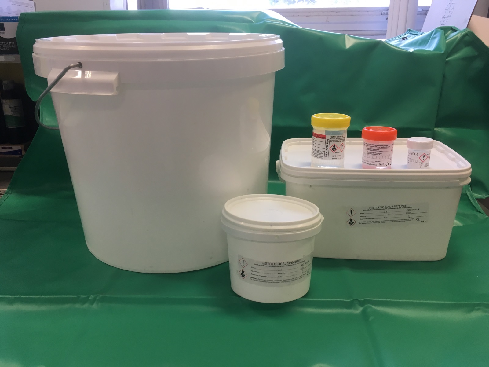 Formalin Filled Specimen Containers / Cellular Pathology / Exeter ...